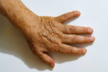 Yaşlı yaşlı kadın elleri buruşuk cilt