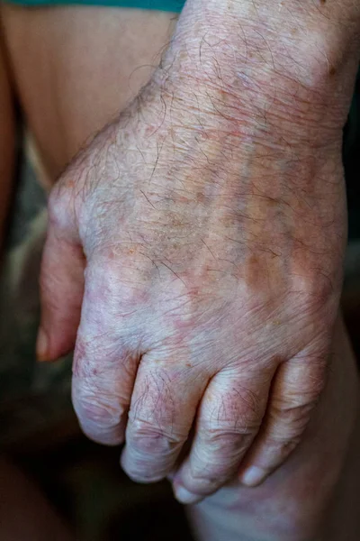 Envelhecimento velha mulher sênior mãos pele enrugada — Fotografia de Stock