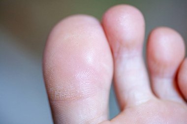 Genç kızların parmakları sağlıklı ve güzeldir..