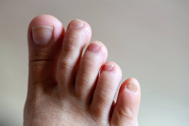 Genç kızların parmakları sağlıklı ve güzeldir..