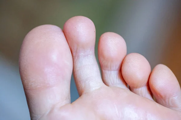 Young girls toes are healthy and beautiful. — Stock Photo, Image