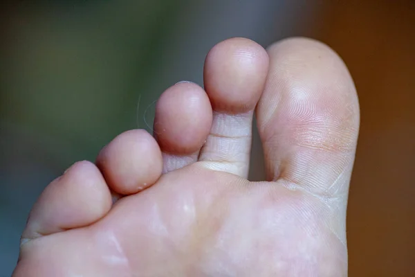 young girls toes are healthy and beautiful.