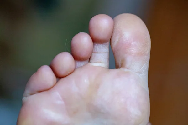 young girls toes are healthy and beautiful.