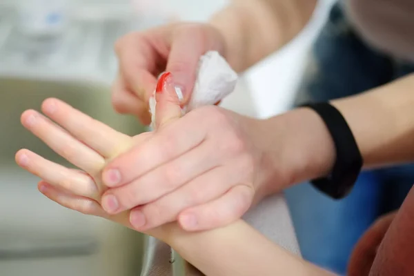 Руки Матери Наносят Антибактериальную Медицинскую Штукатурку Палец Ребенка После Ранения — стоковое фото