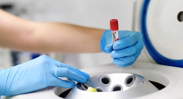 Uomo Del Laboratorio Mette Tubo Della Centrifuga Con Sangue Prova — Foto Stock