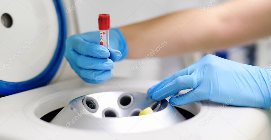 Lab man puts in centrifuge tube with blood for testing coronavirus.Tests for detection virus Sars-cov-2 causing covid-19 and specific antibodies IgM and IgG meaning that exists immunity.Vaccine covid.