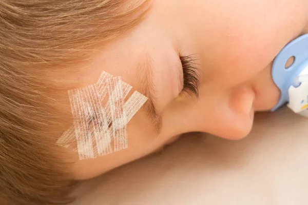 A child with a band-aid on stitched forehead in an accident — Stock Photo, Image