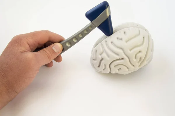 Un neurólogo, sosteniendo un martillo neurológico, realiza exámenes del cerebro. La idea para el examen del paciente o una encuesta médica en la dirección de la neurología y la medicina interna —  Fotos de Stock