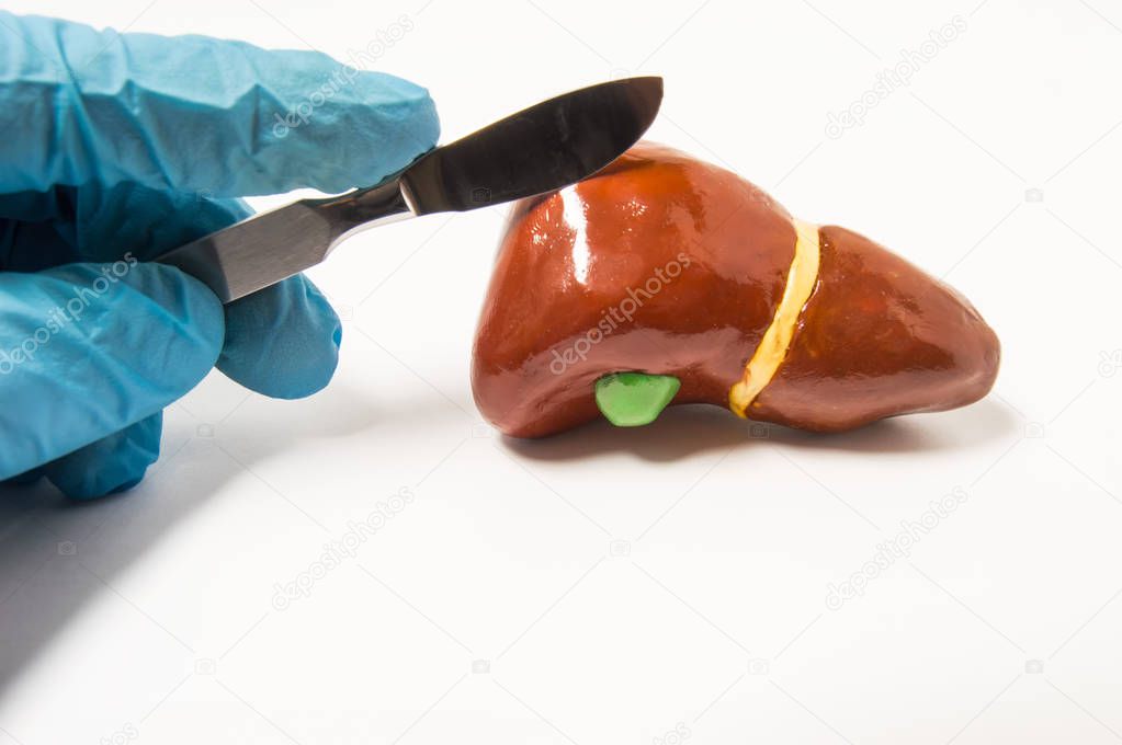 Surgeon's hand in blue latex glove holding scalpel over anatomical figure of human liver. Concept that symbolizes process of surgery treatment of liver diseases such as cancer, hydatid disease ets.