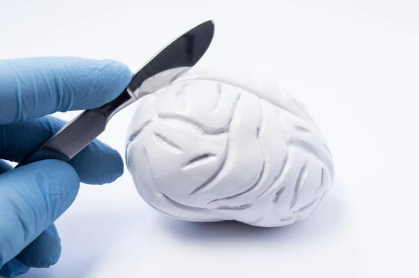 Az agysebészet vagy az idegsebészet fogalma. Az idegsebész szikét tart a kezében az emberi agy 3D anatómiai modellje felett. Agyműtét betegségek kezelésére - tumor, aneurizma, epilepszia — Stock Fotó