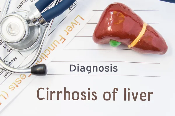 Cirrhosis of the liver diagnosis. Anatomical 3D model of human liver is near stethoscope, results of laboratory tests of liver function and printed on notepad diagnosis of Cirrhosis of liver