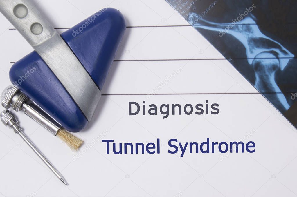 Neurological diagnosis of Tunnel syndrome. Neurologist directory, where is printed diagnosis Tunnel syndrome, lies on workplace with MRI image and neurological diagnostic tools close up
