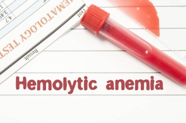 Diagnosis Hemolytic Anemia. Notepad with text labels Hemolytic Anemia, laboratory test tubes for the blood, blood smear for microscopy, and results of laboratory test of blood on table at the doctor clipart