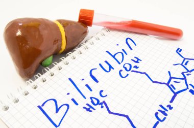 Bilirubin, liver and blood. Model of liver with gallbladder, lab test tube with blood lying on note on which drawn bilirubin and chemical formula. Concept for test or research bilirubin level in blood clipart
