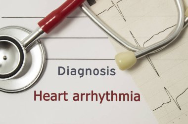 Kalp Ritim bozukluğu, kalp tanı. Doktor çalışma alanı üzerinde kırmızı stetoskop, kağıt EKG çizgi ve kalp ritim bozukluğu tanısı belirtilen tıp el kitabı üzerinde yalan bir kalem yakın çekim üzerinde yazılı olan