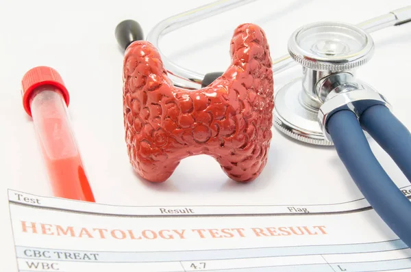 O modelo anatômico da glândula tireóide, o estetoscópio e os resultados das análises ao sangue estão na mesa do médico. Conceito para o diagnóstico ou teste de doenças da tireóide através de exames de sangue da tireóide e distúrbios do tratamento — Fotografia de Stock