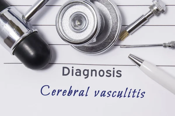 Diagnose van cerebrale Vasculitis. Verklaring van de arts de diagnose cerebrale Vasculitis is op de werkplek van de neuroloog, die zijn stethoscoop, hamer en instrumenten om te bepalen van de gevoeligheid — Stockfoto