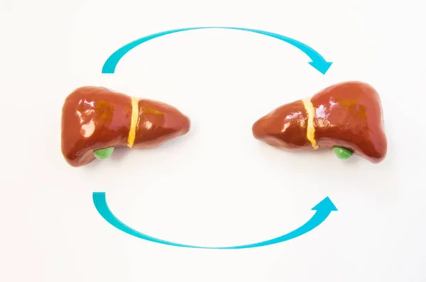 Concept de transplantation hépatique. Deux modèles 3D du foie humain sont opposés avec des flèches l'un à l'autre. Photo ou illustration montrant le processus de transplantation hépatique du donneur au receveur — Photo