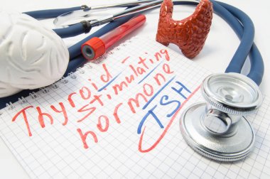 Tiroid hormonu uyarıcı ile yazılı defter stetoskop, beyin tiroid, kan testi tüpler tarafından çevrili yatıyor. Hipofiz bezi tiroid uyarıcı hormon yüksek veya düşük düzeyde laboratuvar analizi 