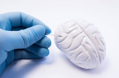 Beyin dokusunun biyopsi kavramı. Holding cerrah iğne ponksiyon ve sinir hücrelerinin yakalamak için beynin ponksiyon hazırlanıyor. Beyin Hastalıkları Parkinson hastalığı gibi invaziv tanı