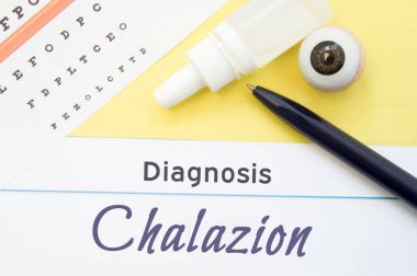 Görme keskinliği, göz damlaları ve göz anatomik model yalanların yazıt tanı Chalazion yanındaki test etmek için grafiği. Tanı, tedavi ve Chalazion oftalmik hastalıkların önlenmesi için konsept fotoğraf