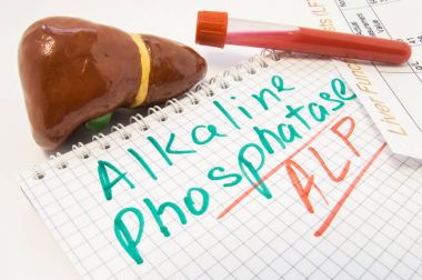 Liver figure, test tubes with blood, liver function test result are near inscription Alkaline Phosphatase ALP. Value of Alkaline Phosphatase as lab indicator in biochemistry, its levels and functions clipart