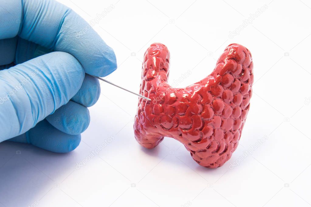 Biopsy of thyroid gland procedure. Doctor hold puncture needle in hand near anatomical 3D model of thyroid gland, ready to pierce its tissue. Concept photo for invasive diagnosis of thyroid disease