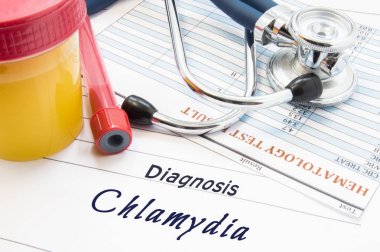 Diagnosis Chlamydia. Stethoscope, lab test tube with blood, container with urine and result of blood laboratory analysis are near doctor's opinion diagnosis of STDs disease Chlamydia clipart