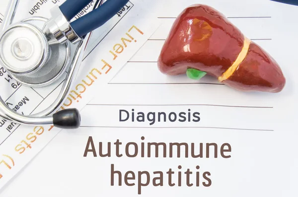 Diagnóstico de hepatitis autoinmune. El modelo anatómico 3D del hígado humano está cerca del estetoscopio, los resultados de las pruebas de laboratorio de la función hepática e impresos en el diagnóstico del bloc de notas de la hepatitis autoinmune — Foto de Stock