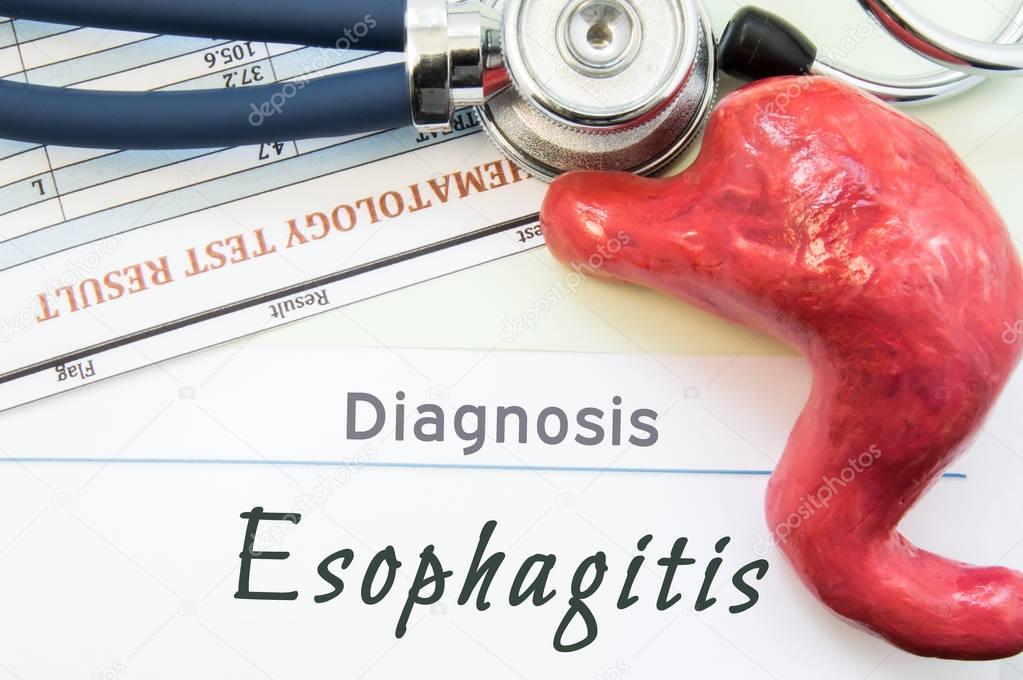 Model of stomach, blood test and stethoscope lying next to written title on paper diagnosis Esophagitis. Concept photo of causes, diagnostic, treatment and prevention of gastric Esophagitis 