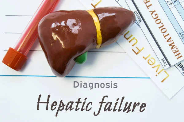 Hepatic failure diagnosis. Sheet of paper or book with inscription Hepatic failure lie next to stethoscope, model of human liver and two lab tests - common blood test and analysis of liver functions