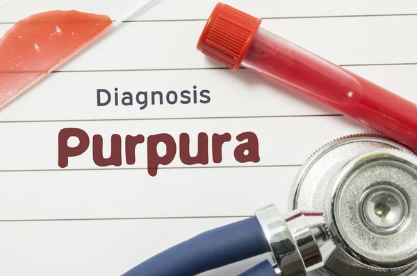 Diagnose van Purpura. Medische boek met tekst kop hematologische diagnose Purpura ligt op arts tafel omringd door laboratorium test tubes met bloed, glasplaatje met bloed-uitstrijkje en stethoscoop — Stockfoto