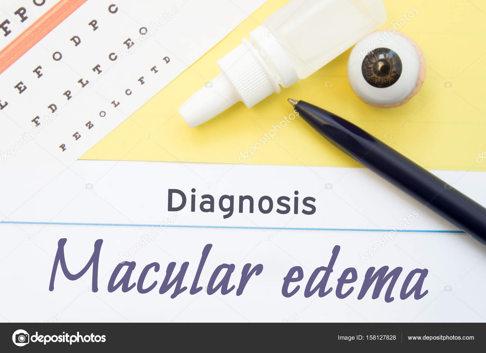 Edema Chart