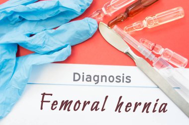 Tanı Femoral fıtık. Mavi eldiven, cerrahi neşter, şırınga ve ampül ilaç ile yazıt yanında Femoral fıtık yalan. Nedenleri, belirtileri, teşhis, tedavi, cerrahi bu hastalık diyet