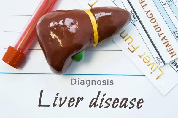 Diagnostic de maladie du foie. Feuille de papier ou livre avec inscription Maladie du foie à côté du stéthoscope, du modèle du foie humain et de deux tests de laboratoire : test sanguin commun et analyse des fonctions hépatiques — Photo