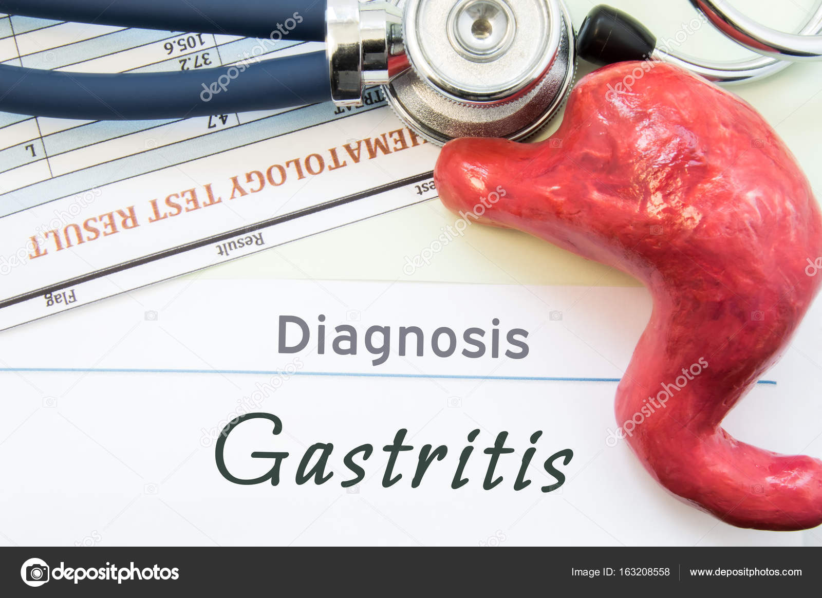 Symptoms of chronic gastritis. Disease treatment and prevention Symptoms of chronic gastritis. Disease treatment and prevention