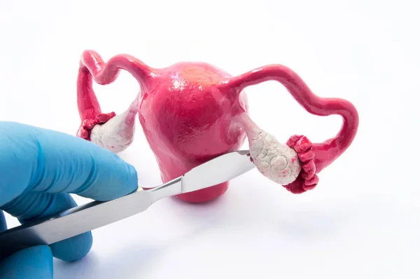 Ovarian gynecologic surgery concept. Hand of surgeon with scalpel near female genitals symbolizes surgical intervention such as cancer, removing ovaries and tubes, cysts and cystectomy as treatment — Stock Image Ovarian gynecologic surgery concept. Hand of surgeon with scalpel near female genitals symbolizes surgical intervention such as cancer, removing ovaries and tubes, cysts and cystectomy as treatment Stock Image
