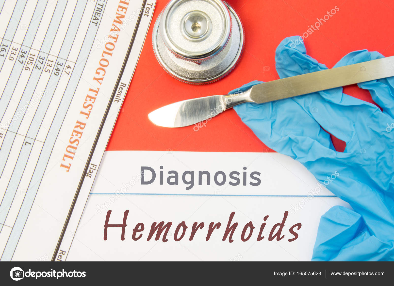 İç hemoroid belirtileri, nedenleri ve tedavisi İç hemoroid belirtileri, nedenleri ve tedavisi