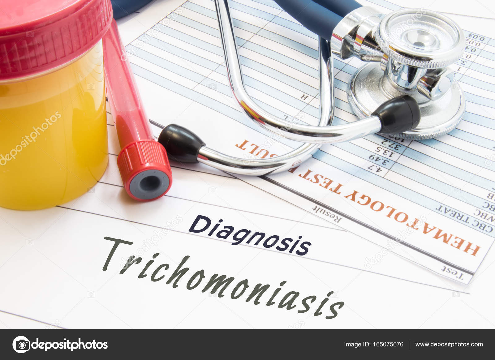 Trichomoniasis: belirtiler, sonuçları, tanı, tedavi Trichomoniasis: belirtiler, sonuçları, tanı, tedavi