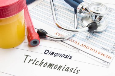 Diagnosis Trichomoniasis. Stethoscope, lab test tube with blood, container with urine and result of blood laboratory analysis are near doctor's opinion diagnosis of STDs disease Trichomoniasis  clipart