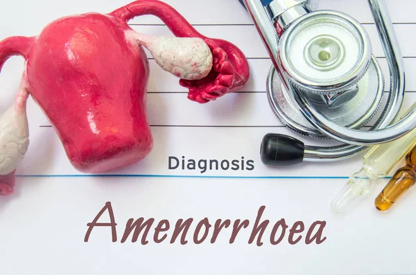 Diagnosis of Amenorrhea. Medical history of patient with diagnosis of Amenorrhea inscription next to stethoscope, uterus with ovaries figure, ampoule with medicine. Treatment and diagnostic concept — Stock Photo, Image