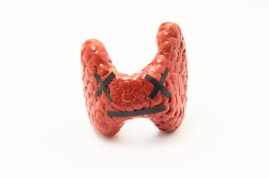 Konsept fotoğraf ölümün organ, ölümcül hastalığı veya tiroid yetmezliği işlevi de. Anatomik şekil duygu ölü gülümseme ile tiroid hormon yetmezliği, ciddi hastalıklar - sembolize kanser vb