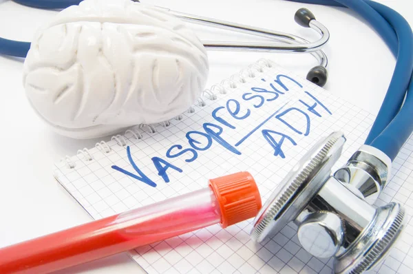 Lab test tube with blood stethoscope brain lie near note labeled hormone Vasopressin or antidiuretic hormone ADH. Diagnosis vasopressin level, function and reason for development of diabetes insipidus