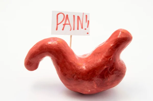 Ilustración concepto de síntoma de dolor o síndrome en patologías y enfermedades del estómago como úlcera, gastritis, acidez estomacal. Modelo anatómico del estómago está al lado de cartel en el que escrito en rojo dolor palabra — Foto de Stock