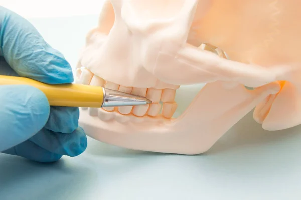 Backenzähne am Ober- und Unterkiefer am anatomischen Modell des menschlichen Schädels. Zahnarzt zeigt dem Patienten Zähne - Backenzähne, die in der Klinik diagnostiziert und behandelt werden müssen — Stockfoto