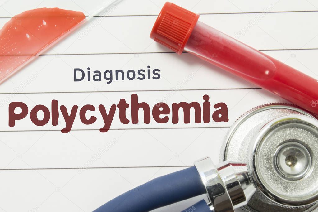 Diagnosis of Polycythemia. Medical book with text header hematological diagnosis Polycythemia lies on table surrounded by laboratory test tubes with blood, glass slide with blood smear and stethoscope