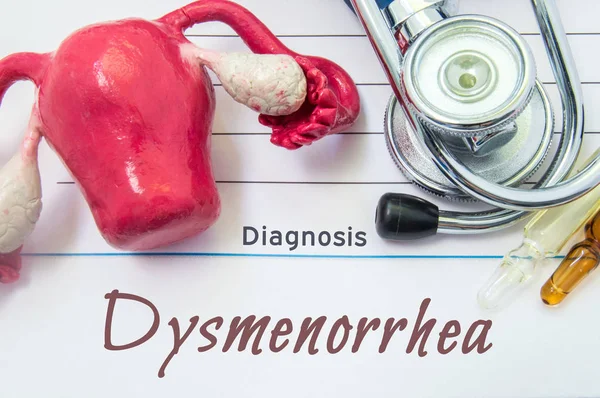 Diagnosis of Dysmenorrhea. Medical history of patient with Diagnosis of Dysmenorrhea inscription next stethoscope, uterus with ovaries figure, ampoule with medicine. Treatment and diagnostic concept — Stock Photo, Image