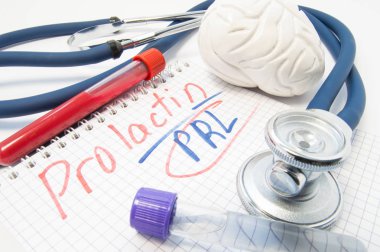 Hormon prolaktin (Rusya). Beyin şekil, laboratuvar test tüpleri kan, yazıt prolaktin yanında yalan stetoskop ile. Bu hormon vücut, işlevleri, normal ve anormal kan düzeyi üzerine etkisi 