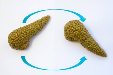 Pankreas nakli konsept fotoğraf. Pankreas bezinin üst üste crossing, nakli işlem veya işlem insan organ simgeleyen iki ok ile iki anatomik modeller