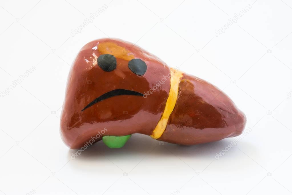 Concept photo of unhappy, sad liver with sickness disorder. Model of liver gallbladder  with sad smile, which symbolizes hepatobiliary problem: discomfort, pain in right side of abdomen, ache, spasm